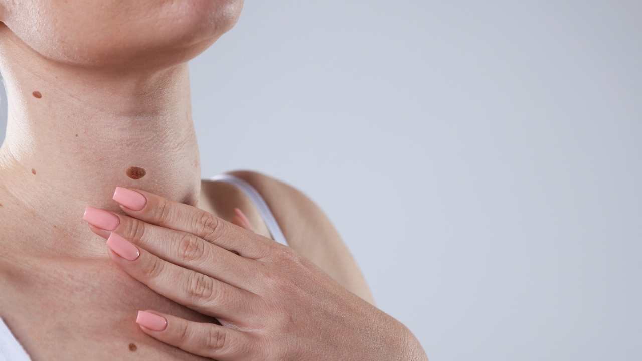 Benlerinizdeki küçük değişiklikleri göz ardı etmeyin: Melanomda erken tanı neden bu kadar önemli?
