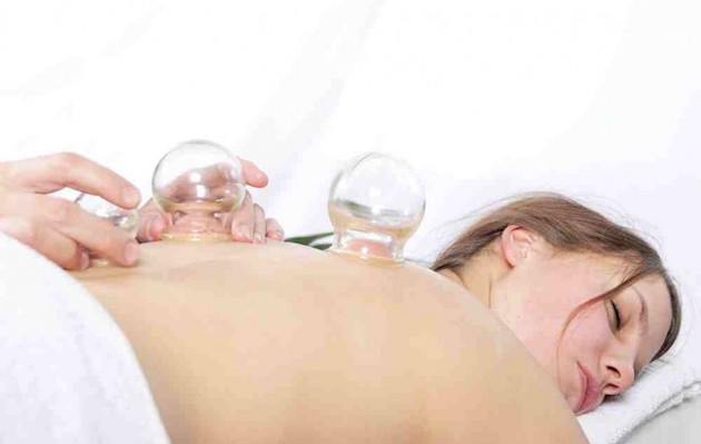 cupping2